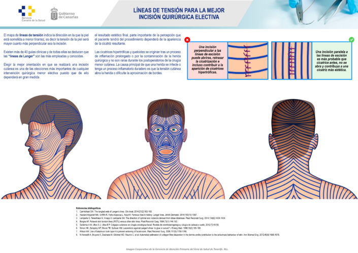 Líneas de Langer Cara. Líneas de tensión para la mejor incisión quirúrgica electiva (H)