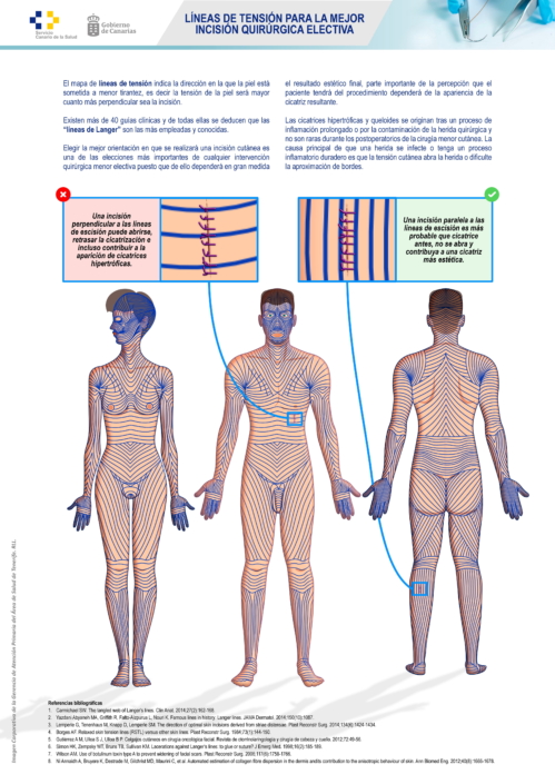 Líneas de Langer. Líneas de tensión para la mejor incisión quirúrgica electiva (V)